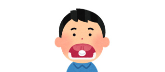 舌下免疫療法