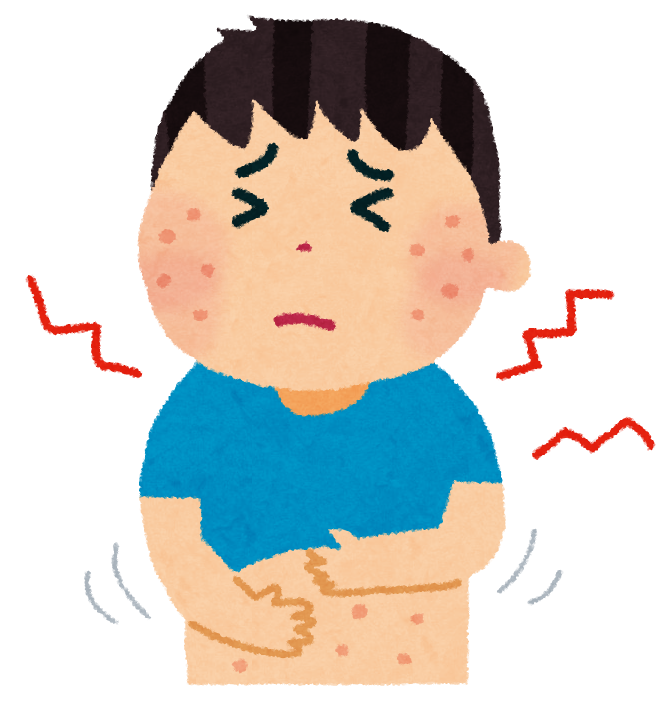 皮膚の症状のイラスト